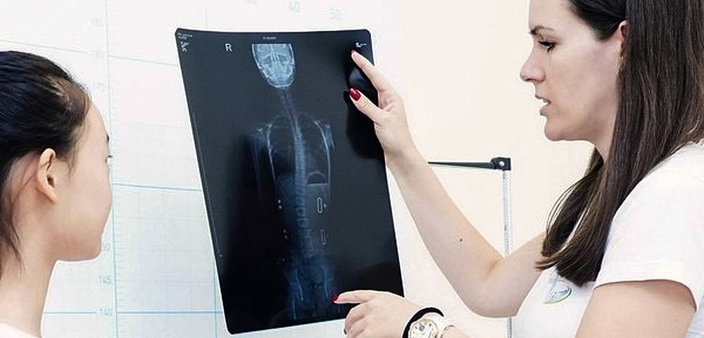 Scolios is more common in girls